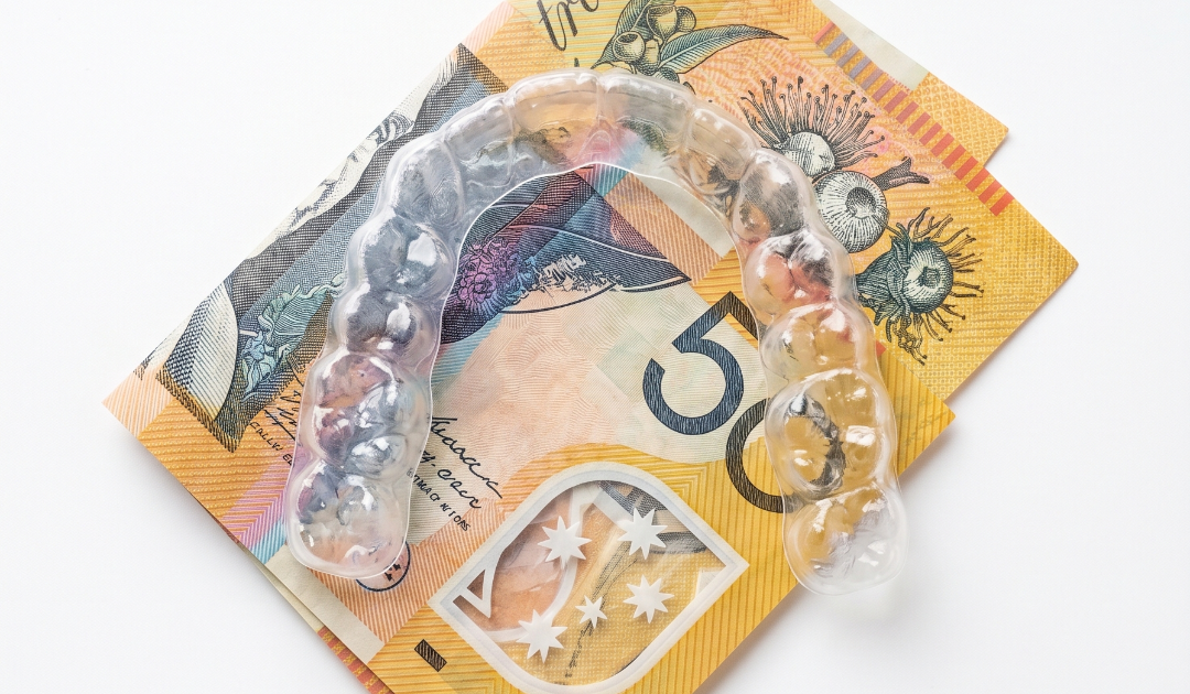 How Much Do Clear Aligners Cost in Australia? (2026 Guide)