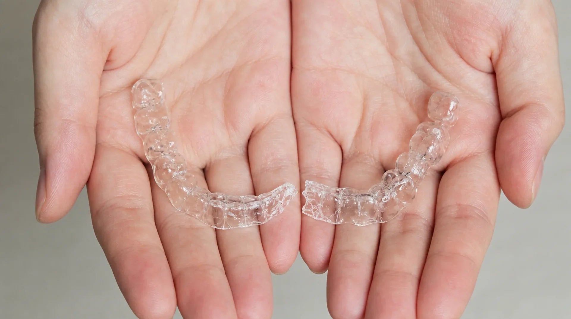 My Retainer Broke... What Actually Happens Next?