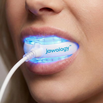 Jawology Teeth Whitening Kit