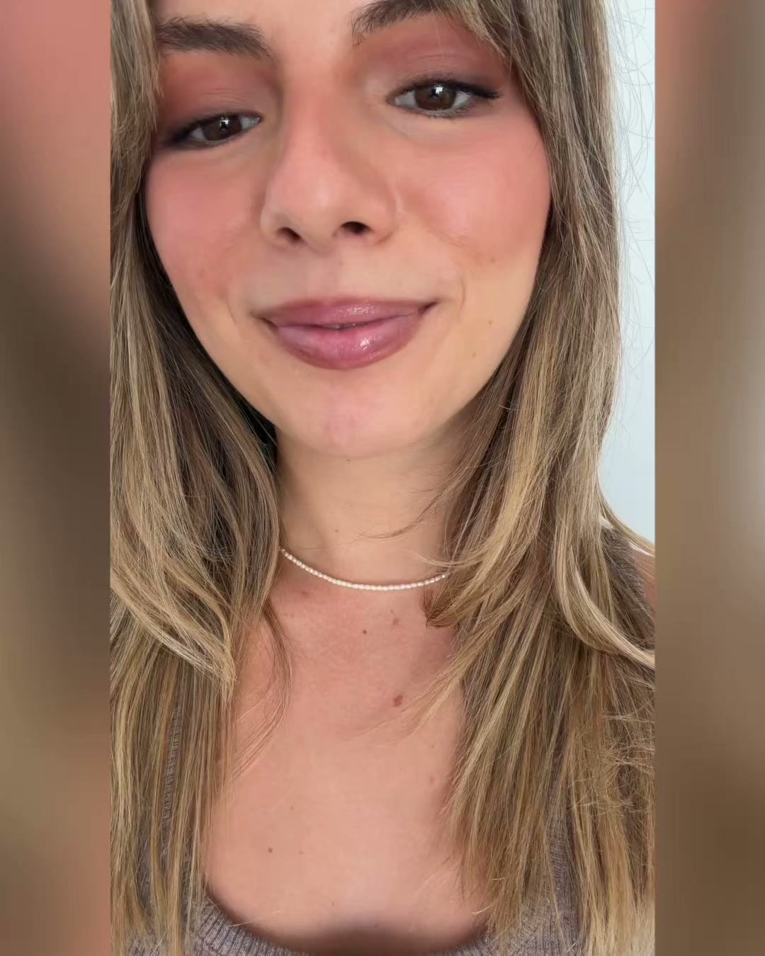 Jawology patient talking about her experience with clear aligner treatment