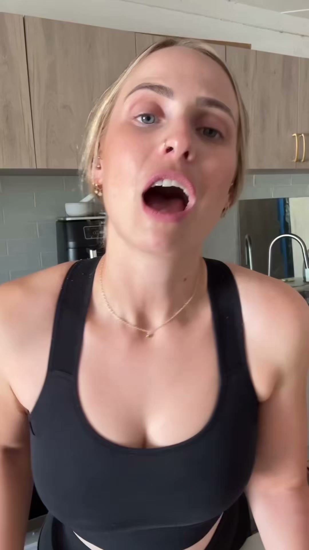 Jawology patient talking about her experience with clear aligner treatment